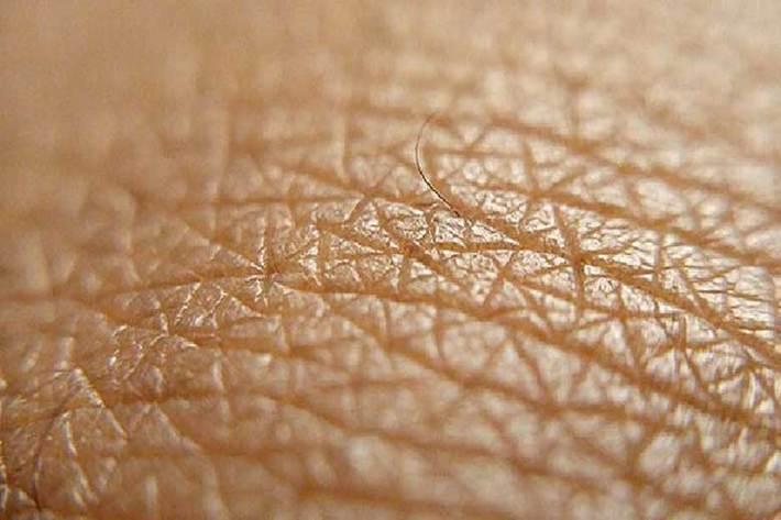 ابداع یک پوست آزمایشگاهی با قابلیت رویش مو